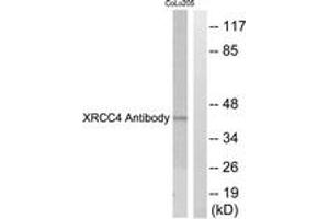Western blot analysis of extracts from COLO205 cells, using XRCC4 Antibody. (DIRC2 antibody  (AA 261-310))