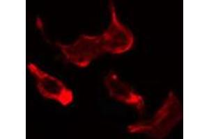 ABIN6274690 staining HuvEc cells by IF/ICC. (Laminin gamma 1 antibody  (N-Term))