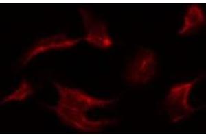 ABIN6266453 staining Hela by IF/ICC. (MAPK15 antibody  (pThr175, pTyr177))