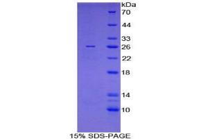 SDS-PAGE analysis of Mouse FKBP8 Protein.