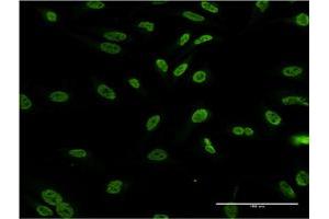 Immunofluorescence of monoclonal antibody to DLX1 on HeLa cell. (DLX1 antibody  (AA 152-255))
