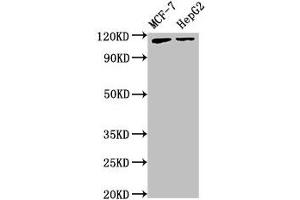 Western Blot Positive WB detected in: MCF-7 whole cell lysate, HepG2 whole cell lysate All lanes: ATP9A antibody at 3.