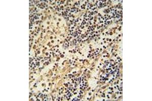 Immunohistochemistry analysis in formalin fixed and paraffin embedded human lymph node reacted with HEMK1 Antibody (C-term) followed  which was peroxidase-conjugated to the secondary antibody, followed by DAB staining. (HEMK1 antibody  (C-Term))