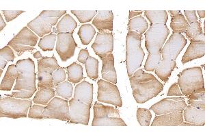 Immunohistochemistry (IHC) image for anti-Matrix Metalloproteinase 2 (MMP2) (AA 110-660) antibody (ABIN7438181)