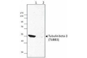 Western Blotting (WB) image for anti-Tubulin, beta 3 (TUBB3) antibody (ABIN2665448) (TUBB3 antibody)