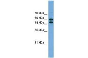 Image no. 1 for anti-Phosphoglucomutase 1 (PGM1) (AA 467-516) antibody (ABIN6746448) (Phosphoglucomutase 1 antibody  (AA 467-516))