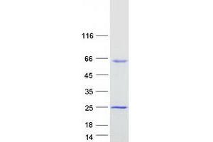 Validation with Western Blot (AAMP Protein (Myc-DYKDDDDK Tag))
