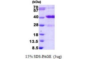 SDS-PAGE (SDS) image for MARCKS-Like 1 (MARCKSL1) (AA 1-195) protein (His tag) (ABIN6387162) (MARCKSL1 Protein (AA 1-195) (His tag))