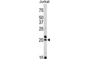 Western Blotting (WB) image for anti-Vasoactive Intestinal Peptide (Vip) antibody (ABIN3002683) (Vip antibody)