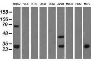 Western blot analysis of extracts (35 µg) from 9 different cell lines by using anti-QPRT monoclonal antibody. (QPRT antibody)