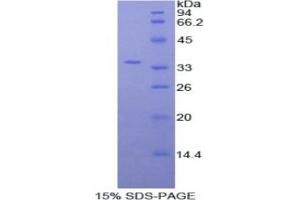 SDS-PAGE analysis of Human Myosin IF Protein. (MYO1F Protein)