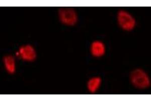ABIN6275128 staining Hela by IF/ICC. (FOXD4 antibody  (Internal Region))
