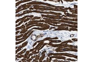 Immunohistochemical staining of human heart muscle with KCNH7 polyclonal antibody  shows strong cytoplasmic positivity in myocytes at 1:1000-1:2500 dilution. (KCNH7 antibody)