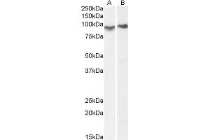 Image no. 1 for anti-ArfGAP with Coiled-Coil, Ankyrin Repeat and PH Domains 2 (ACAP2) antibody (ABIN5893415)