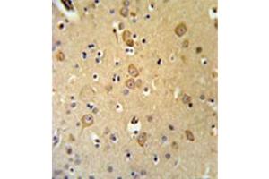 Immunohistochemistry analysis in formalin fixed and paraffin embedded brain tissue reacted with LRRTM1 Antibody (Center) followed which was peroxidase conjugated to the secondary antibody and followed by DAB staining.