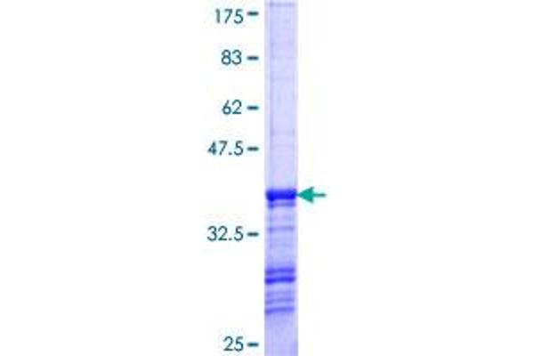 HAGH Protein (AA 161-260) (GST tag)