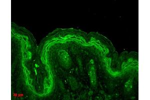 Immunohistochemistry analysis using Rabbit Anti-ERK1 Polyclonal Antibody . (ERK1 antibody  (APC))