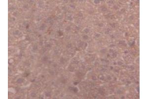 Immunohistochemistry (IHC) image for anti-alpha-2-Macroglobulin (A2M) (AA 1053-1214) antibody (ABIN1857846)