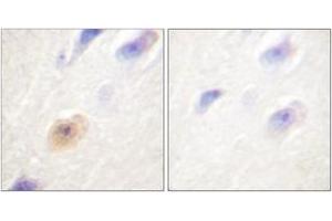 Immunohistochemistry analysis of paraffin-embedded human brain tissue, using CSE1L Antibody. (Exportin 2 antibody  (AA 1-50))