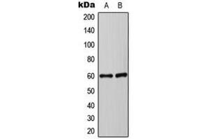 Western blot analysis of Synaptotagmin expression in HEK293T (A), Jurakt (B) whole cell lysates. (Synaptotagmin antibody  (Center))