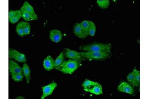 Immunofluorescent analysis of HepG2 cells using ABIN7148675 at dilution of 1:100 and Alexa Fluor 488-congugated AffiniPure Goat Anti-Rabbit IgG(H+L) (CRTC1 antibody  (AA 1-248))