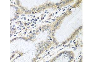 Immunohistochemistry of paraffin-embedded Human stomach using RPN2 Polyclonal Antibody at dilution of 1:100 (40x lens).