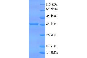 SDS-PAGE (SDS) image for CD59 (CD59) (AA 26-102) protein (GST tag) (ABIN5709239) (CD59 Protein (CD59) (AA 26-102) (GST tag))
