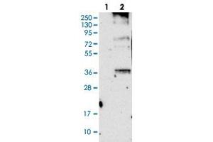 Western blot analysis of Lane 1: Negative control (vector only transfected HEK293T lysate), Lane 2: Over-expression Lysate (Co-expressed with a C-terminal myc-DDK tag (~3. (ORAI3 antibody)
