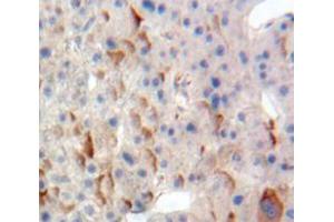 Used in DAB staining on fromalin fixed paraffin-embedded Liver tissue (TPBG antibody  (AA 32-351))