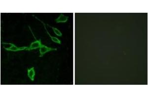 Immunofluorescence analysis of LOVO cells, using HRH1 Antibody.