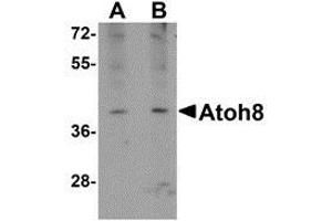 Western blot analysis of ATOH8 in A-20 cell lysate with this product atOH8 antibody at (A) 1 and (B) 2 μg/ml.