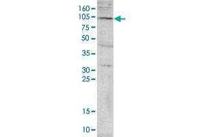 Western blot was performed on nuclear extracts from HeLa cells (HeLa NE, 40 ug) with PADI4 polyclonal antibody , diluted 1 : 1,000 in TBS-Tween containing 5% skimmed milk.
