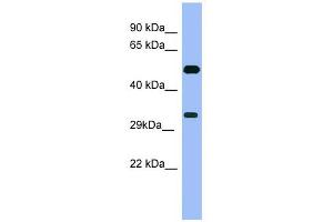WB Suggested Anti-MAGEB1 Antibody Titration: 0. (MAGEB1 antibody  (Middle Region))