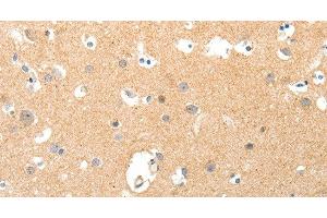 Immunohistochemistry of paraffin-embedded Human brain tissue using TNXB Polyclonal Antibody at dilution 1:40 (TNXB antibody)