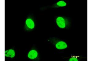 Immunofluorescence of monoclonal antibody to SOX18 on HeLa cell. (SOX18 antibody  (AA 63-150))