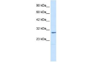 WB Suggested Anti-CLIC2 Antibody Titration:  1. (CLIC2 antibody  (Middle Region))