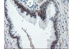 Image no. 1 for anti-Dystrobrevin, beta (DTNB) antibody (ABIN1497913) (Dystrobrevin beta antibody)