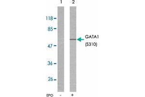 Western blot analysis of extracts from COS7 cells untreated or treated with EPO using GATA1 (phospho S310) polyclonal antibody . (GATA1 antibody  (pSer310))