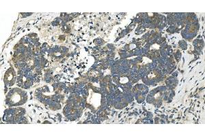 IHC analysis of CDC123 using anti-CDC123 antibody (ABIN7599284). (CDC123 antibody  (AA 1-336))