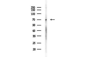 anti-Solute Carrier Organic Anion Transporter Family, Member 1C1 (SLCO1C1) (C-Term) antibody