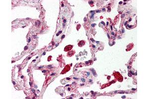 Anti-STAT1 antibody IHC of human lung, alveolar macrophages. (STAT1 antibody  (C-Term))