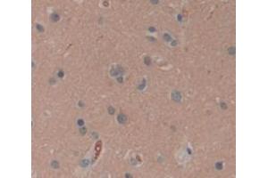 Figure. (SCG2 antibody  (AA 31-617))