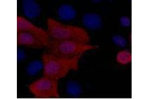 Immunofluorescence (IF) analysis of 293 cells transfected with a His-tag protein,1:1000 dilution (blue DAPI, red anti-His)