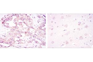 anti-Protein Kinase, AMP-Activated, alpha 1 Catalytic Subunit (PRKAA1) antibody