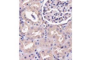 (ABIN6243119 and ABIN6578706) staining COPS7B in human kidney tissue sections by Immunohistochemistry (IHC-P - paraformaldehyde-fixed, paraffin-embedded sections). (COPS7B antibody  (AA 61-95))