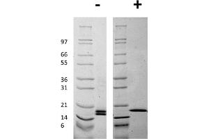 SDS-PAGE of Human Mouse Fibroblast Growth Factor basic Recombinant Protein SDS-PAGE of Mouse Fibroblast Growth Factor basic Recombinant Protein. (FGF2 Protein)