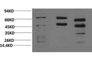 Western Blotting (WB) image for anti-Phosphoserine (Phosphospecific) antibody (ABIN5962159) (Phosphoserine antibody  (Phosphospecific))
