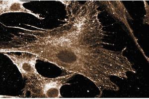 Immunofluorescent staining of human fibroblast cells. (RAC1 antibody)