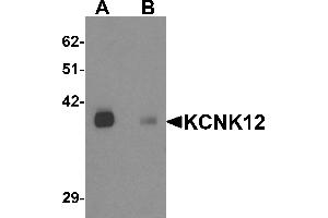 Western blot analysis of KCNK12 in rat brain tissue lysate with KCNK12 antibody at 0. (KCNK12 antibody  (C-Term))