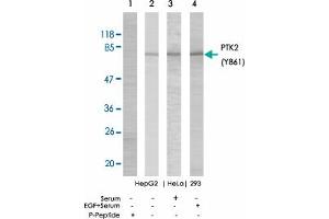 Western blot analysis of extracts from HepG2, HeLa and 293 cells using PTK2 (phospho Y861) polyclonal antibody . (FAK antibody  (pTyr861))